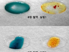 가성비최고 혈액형검사 추천상품