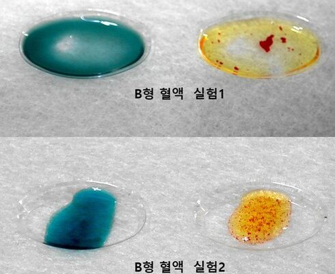 가성비최고 혈액형검사 추천상품